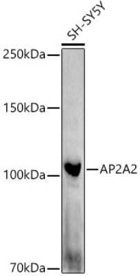 Western Blot: AP2A2 AntibodyAzide and BSA Free [NBP2-92458]